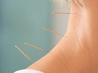Akupunktur am Hals